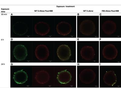 EGFR-targeted bacteriophage lambda penetrates model stromal and colorectal carcinoma tissues, is taken up into carcinoma cells, and interferes with 3-dimensional tumor formation